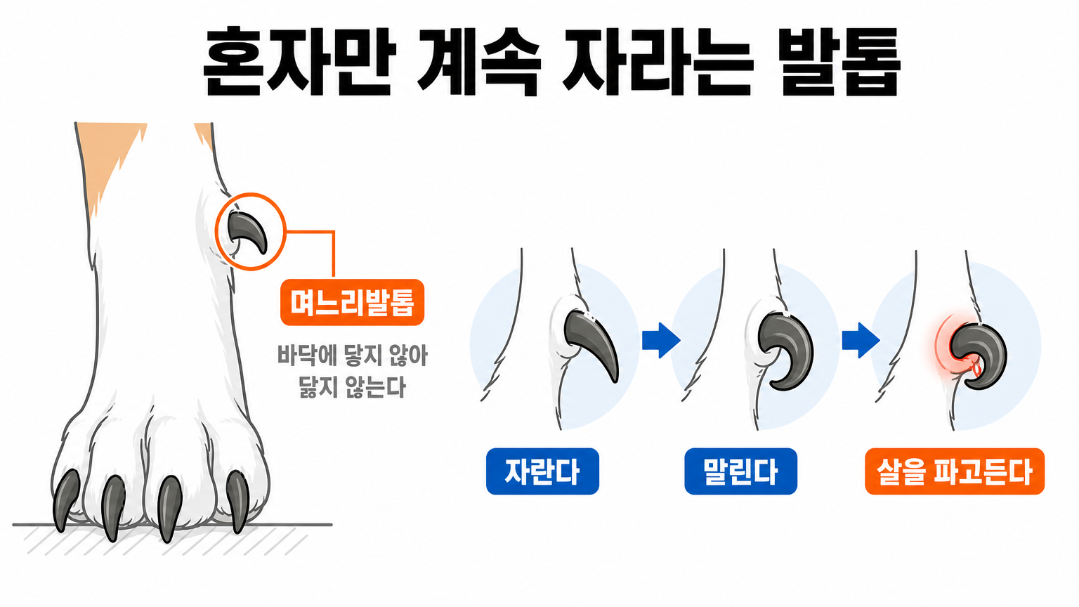 며느리발톱의 위치와 방치했을 때 말려서 살로 파고드는 경로 (댕묘 작성)