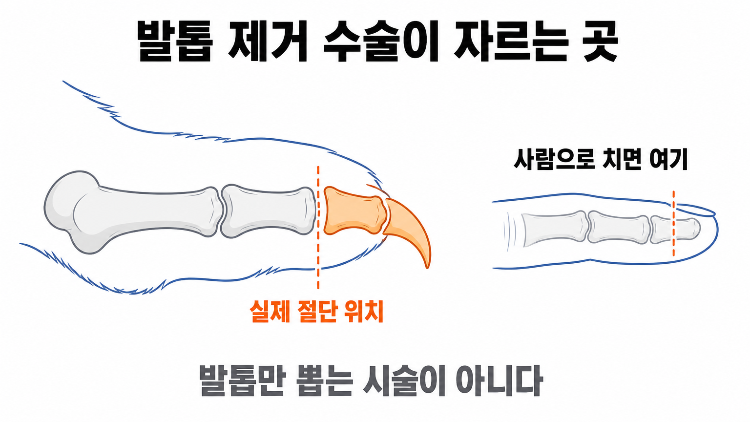 발톱 제거 수술에서 실제로 절단되는 부위 (댕묘 작성)