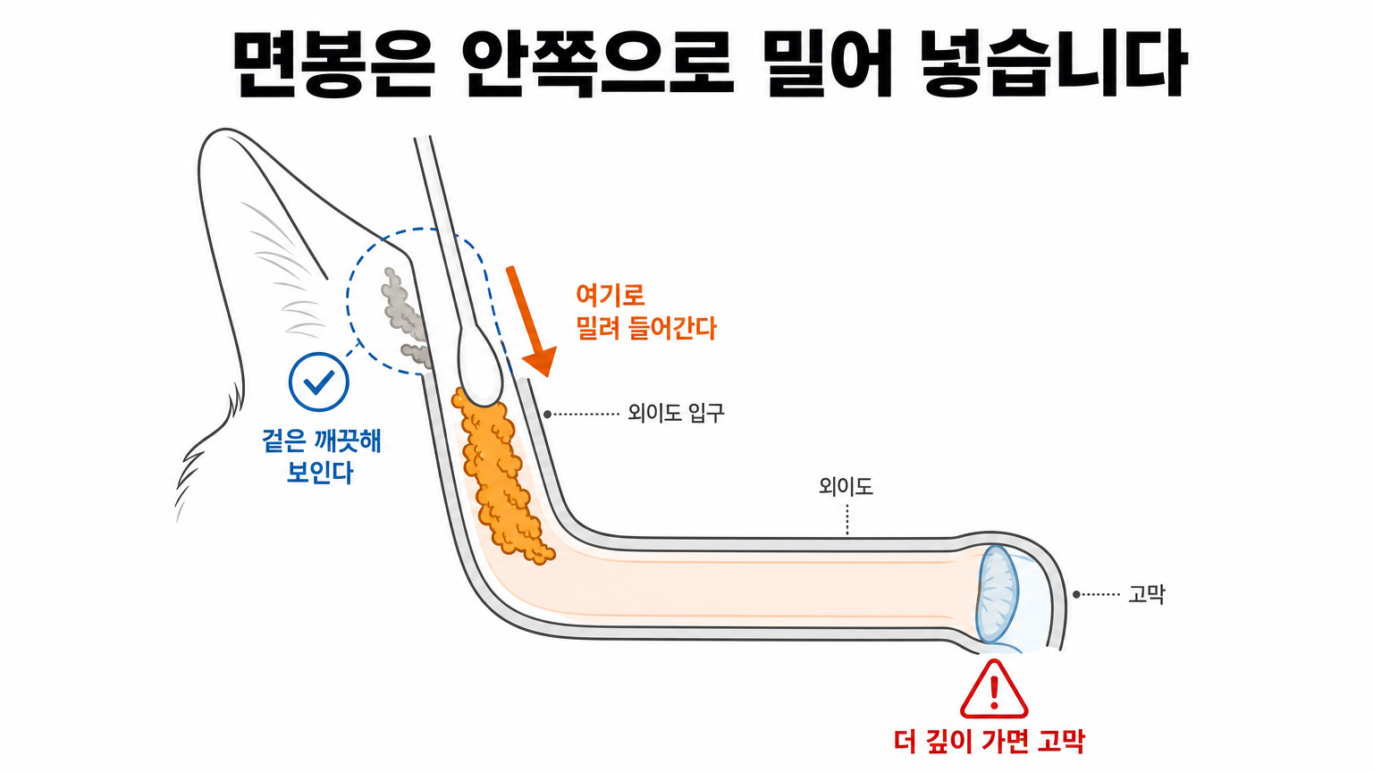 면봉을 넣었을 때 분비물이 밀려 들어가는 경로 (댕묘 작성)
