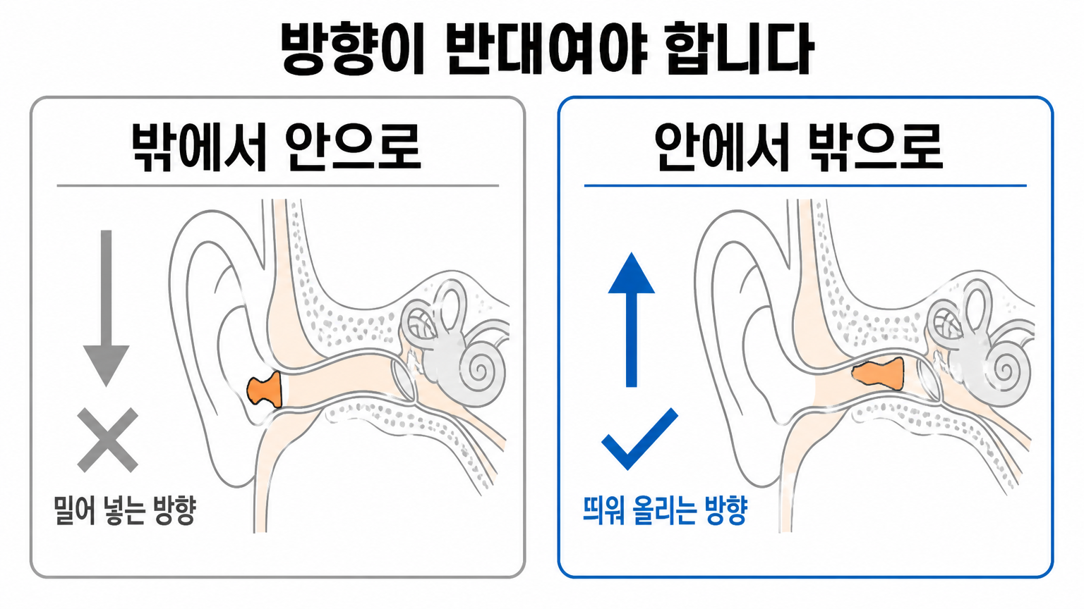 밖에서 안으로 미는 방향과 안에서 밖으로 띄우는 방향 (댕묘 작성)