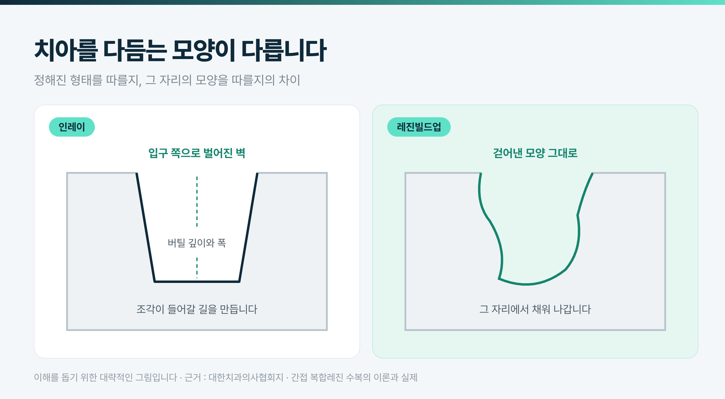 치아를 다듬는 모양이 다릅니다 · 이해를 돕기 위한 대략적인 그림입니다