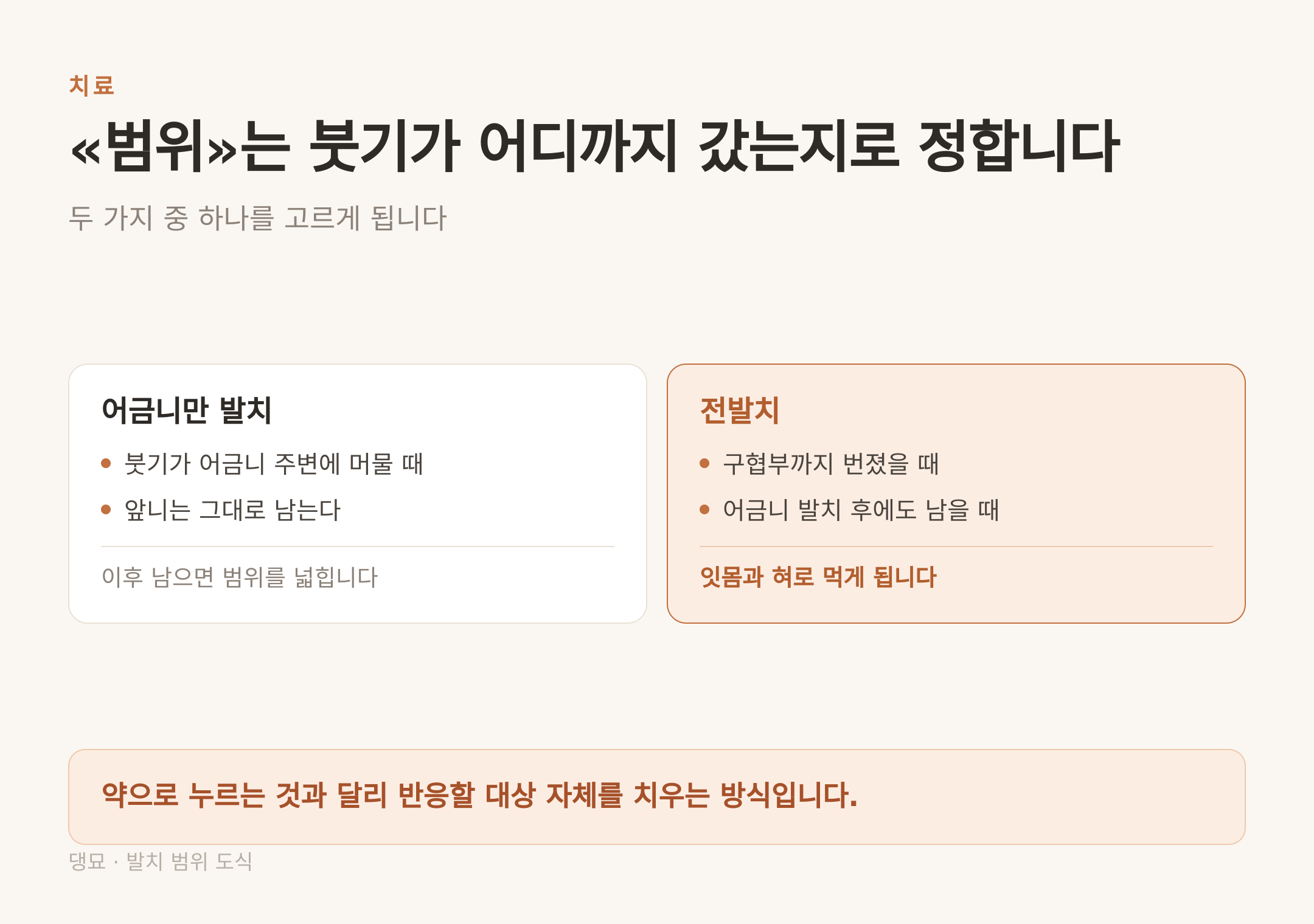 발치 범위는 붓기가 어디까지 번졌는지로 정한다